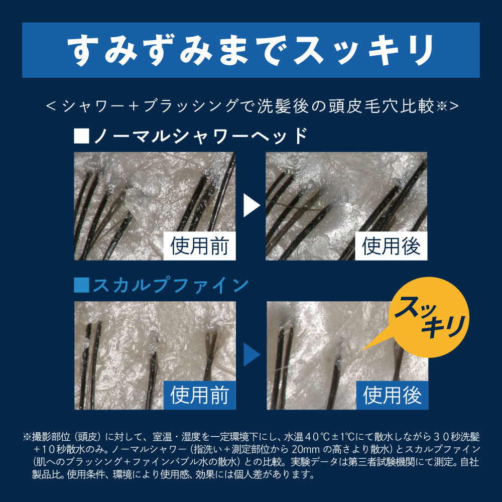 ノーマルシャワーとスカルプファインの使用前後の頭皮毛穴の比較画像。