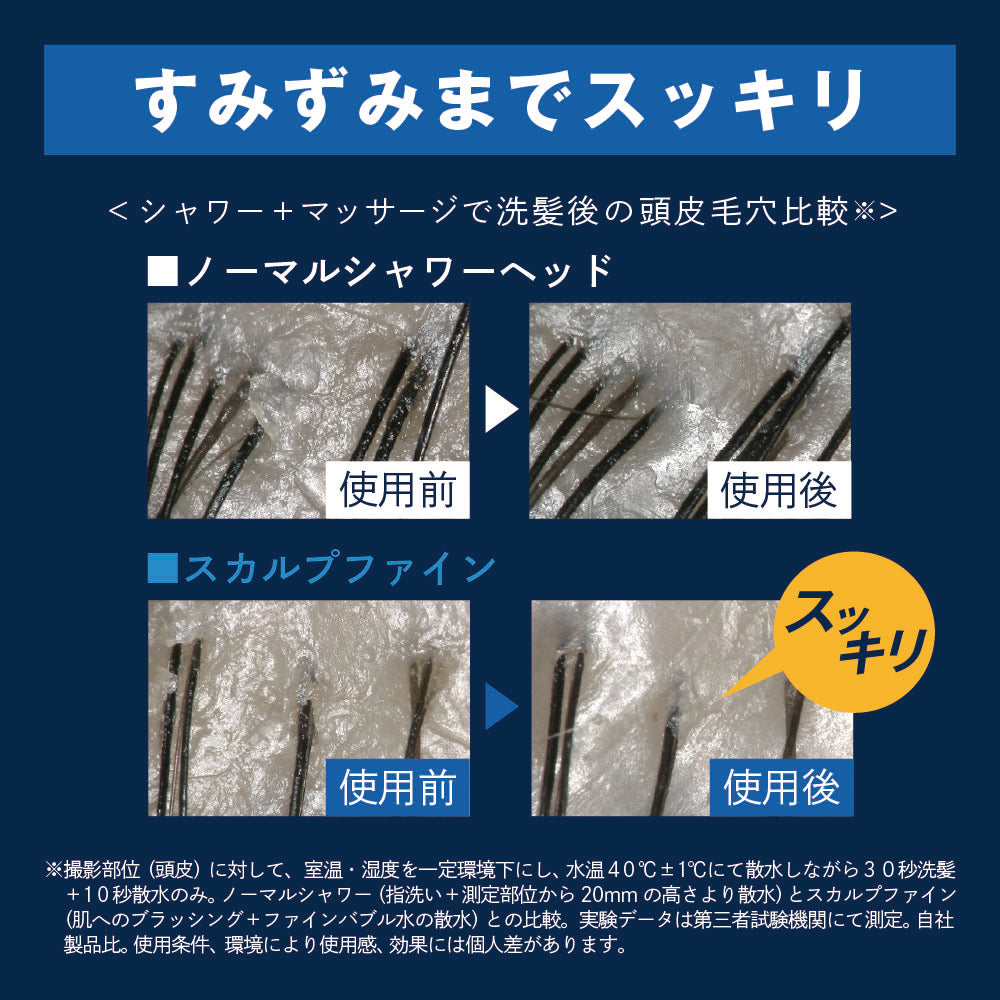 ノーマルシャワーとスカルプファインの使用前後の頭皮毛穴の比較画像。