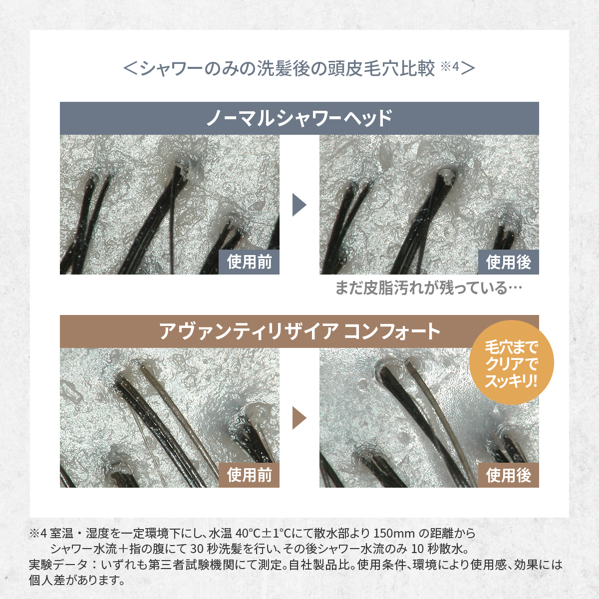 アヴァンティリザイア コンフォート