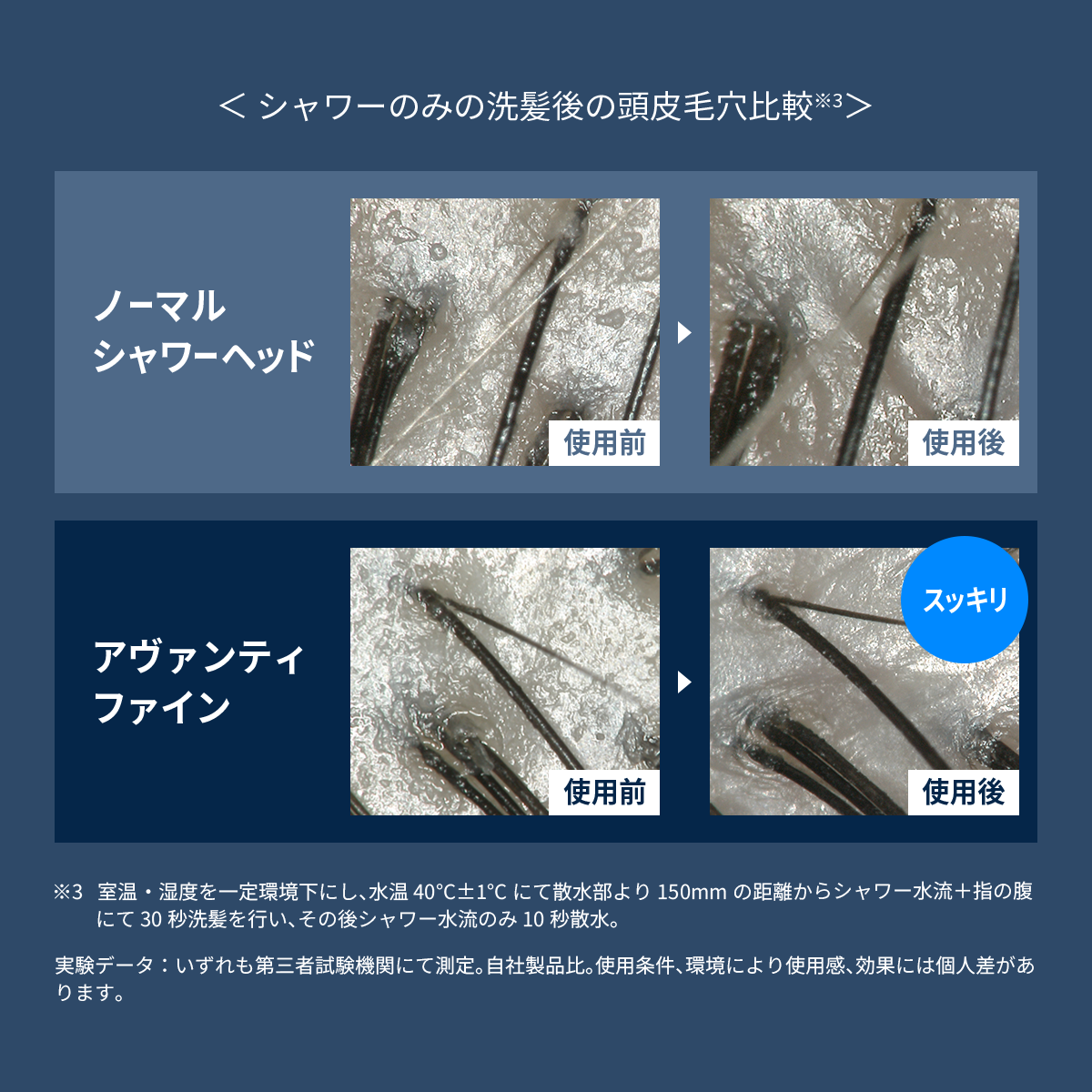 ノーマルシャワーヘッドとアヴァンティファインの洗髪後の頭皮の毛穴の状態の比較画像。